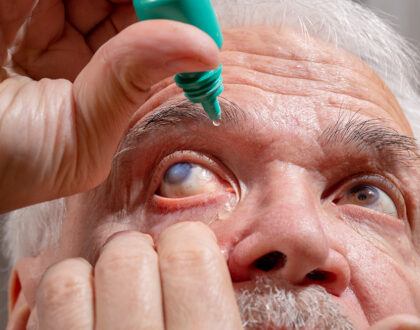 Glaucoma